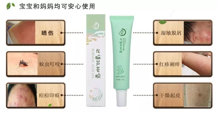 保湿、消炎、止痒、晒后修复,一管芦荟胶全搞定,宝宝也能用