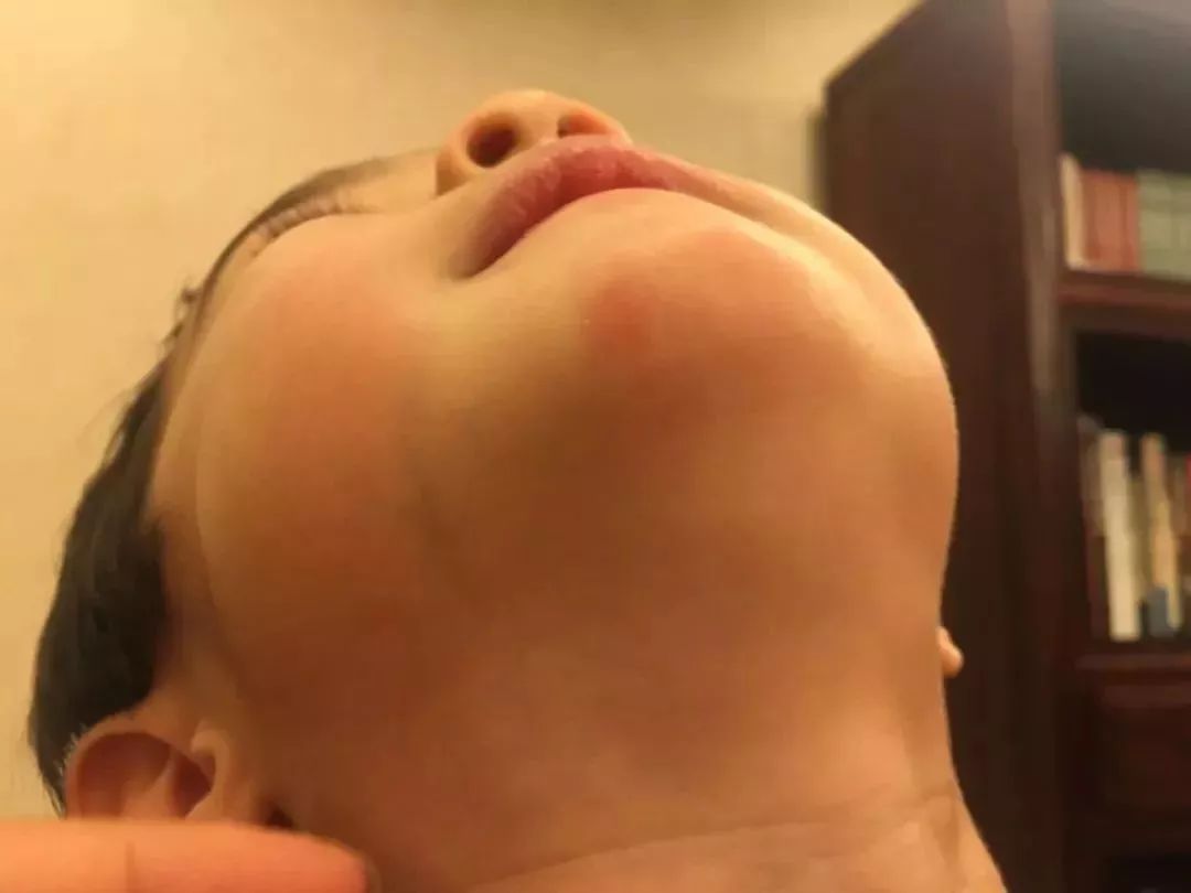 保湿、消炎、止痒、晒后修复,一管芦荟胶全搞定,宝宝也能用