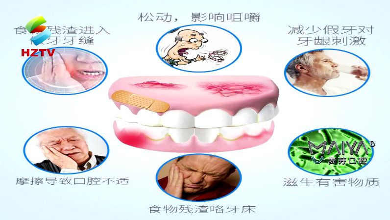 假牙要如何护理不伤害口腔,口腔科健康大讲堂