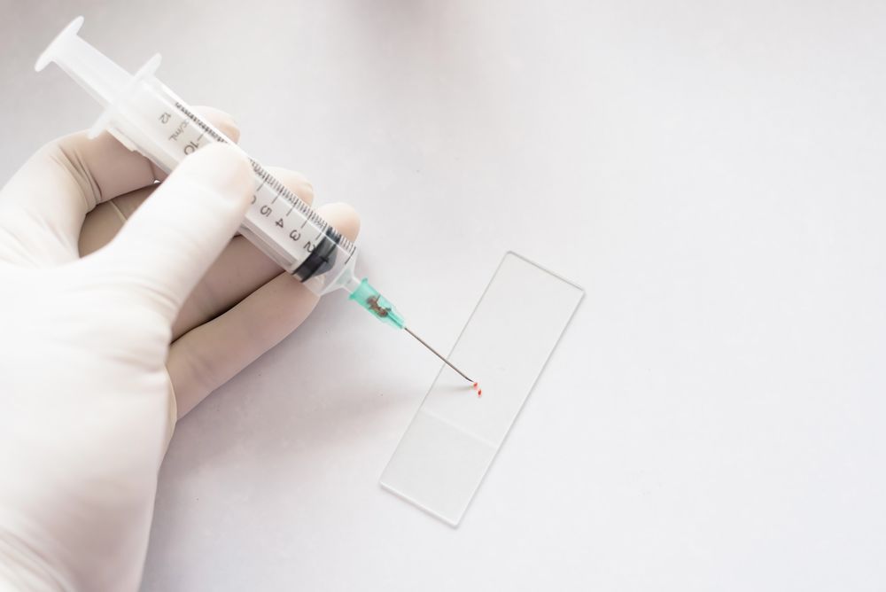 儿童甲状腺癌最佳治疗方案,儿童甲状腺癌治疗最佳方法