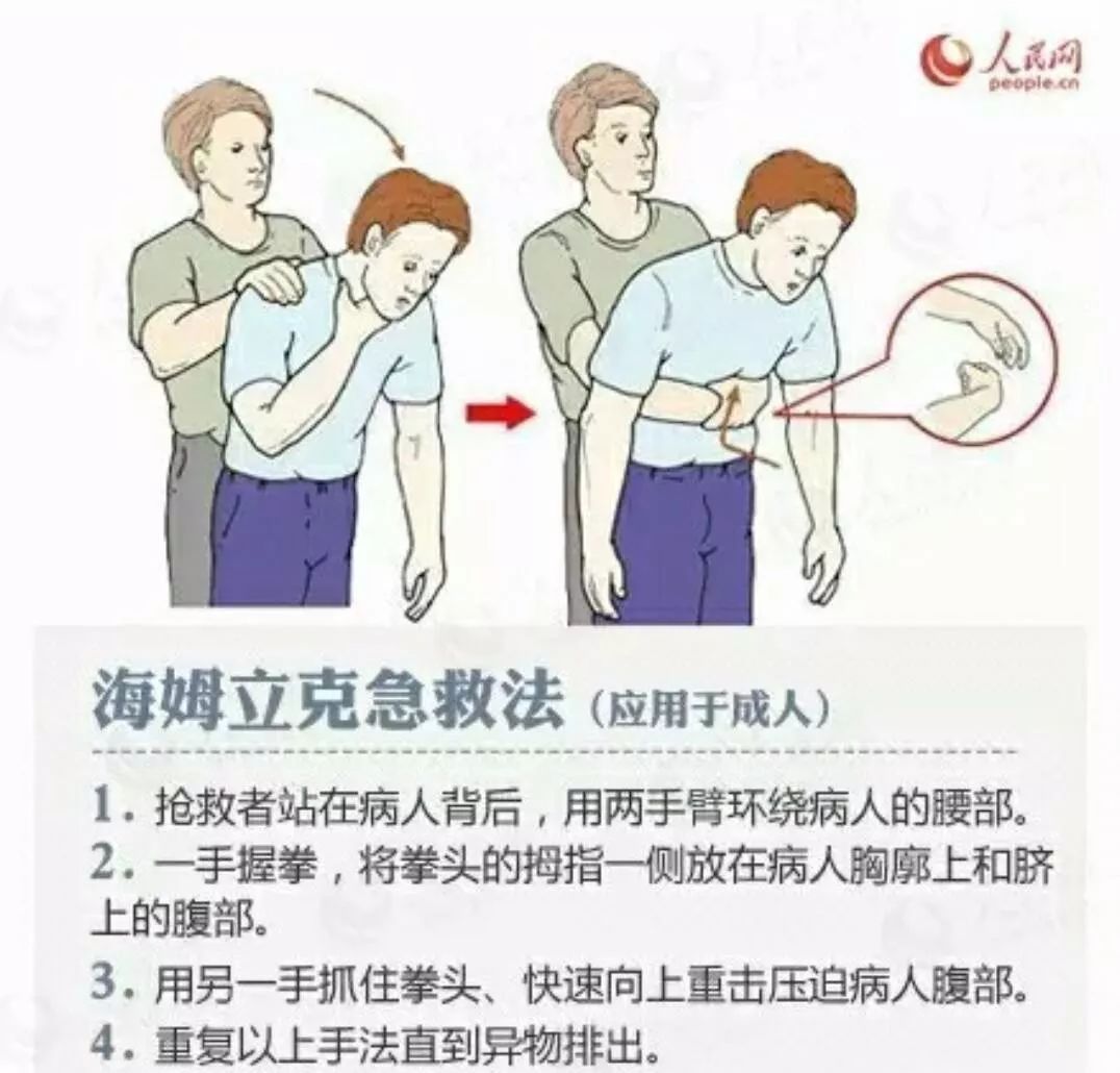 找真相|烫伤抹牙膏?鱼刺卡喉要喝醋?这些家庭急救误区你不可不知