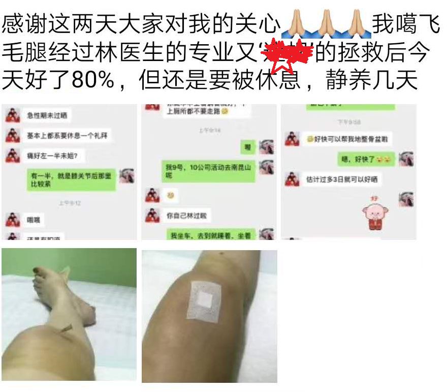 膝盖急性损伤肿过大腿,这样处理后她第二天竟好了八成