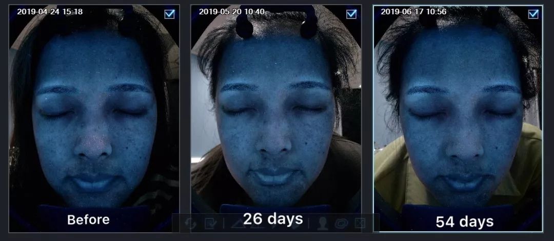 平价精华测评真实推荐,28天精华真实测评