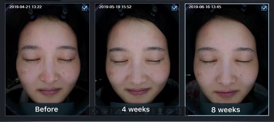 平价精华测评真实推荐,28天精华真实测评