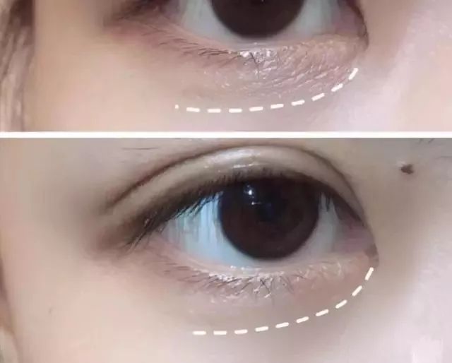 中国年轻人最爱的德国原装进口眼霜！请加入你们双十一的购物清单