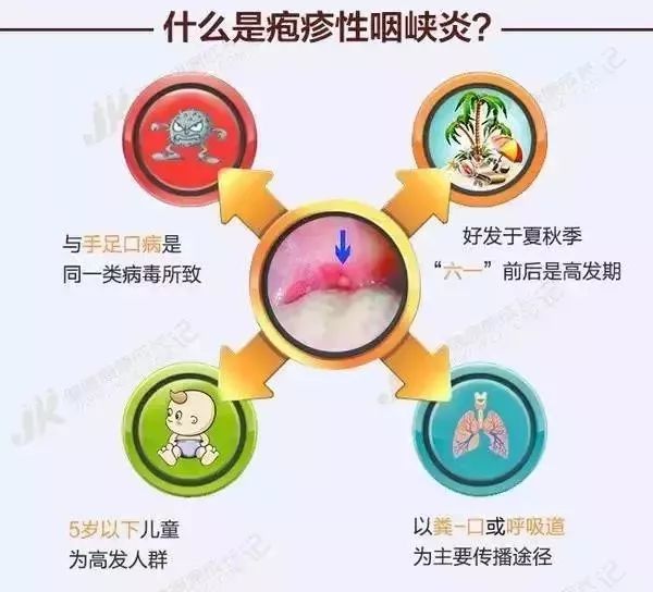 高烧引起疱疹要用什么药,高烧还有带状疱疹