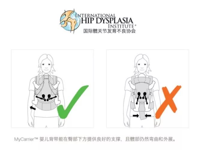 叙好物|累瘫老母亲的暑期来了，这几款火遍INS的出行神器赶紧get起来