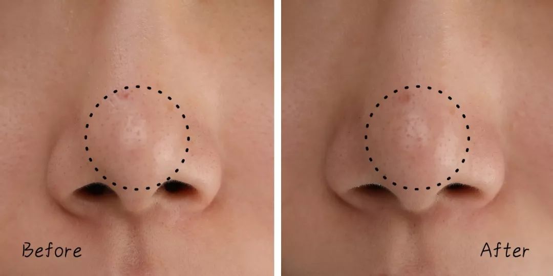 不做清洁面膜护肤品能吸收吗,不做清洁补水有效果吗