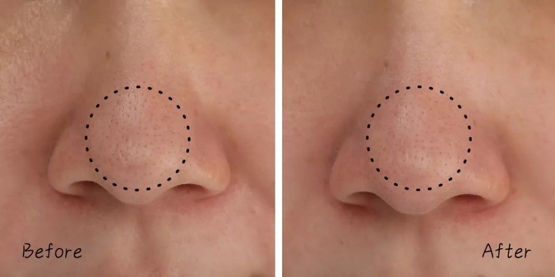 不做清洁面膜护肤品能吸收吗,不做清洁补水有效果吗