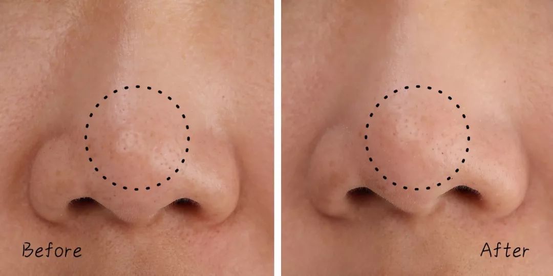 不做清洁面膜护肤品能吸收吗,不做清洁补水有效果吗