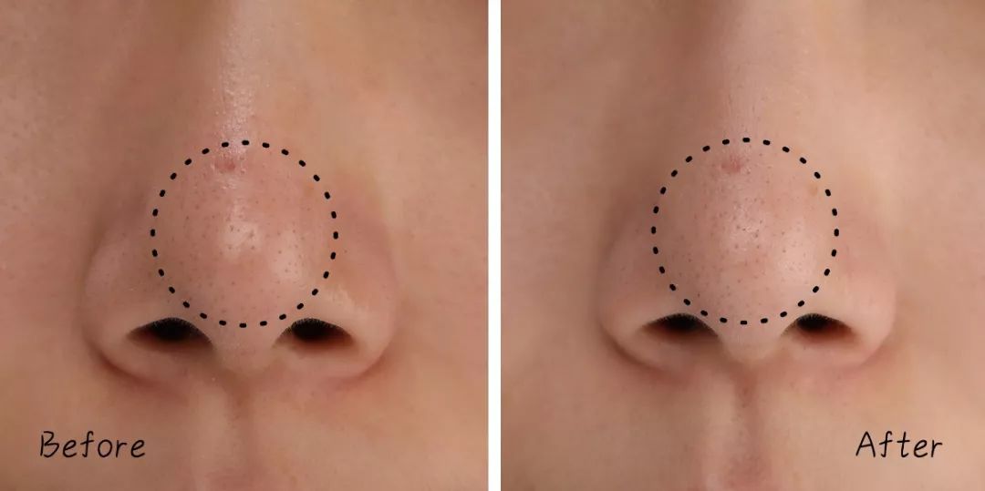 不做清洁面膜护肤品能吸收吗,不做清洁补水有效果吗