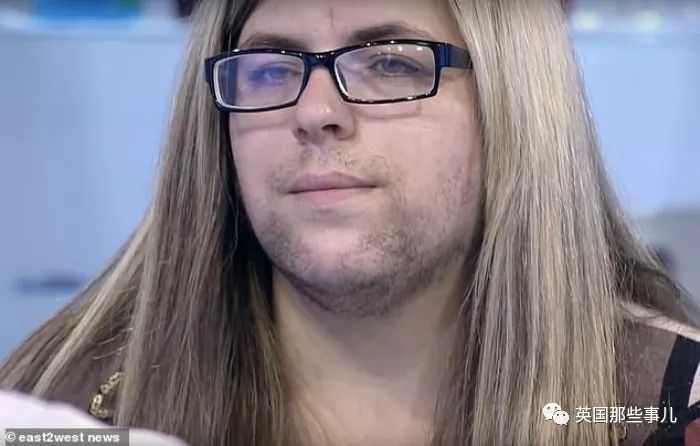 产后长络腮胡,女子生完孩子后长出满脸络腮胡