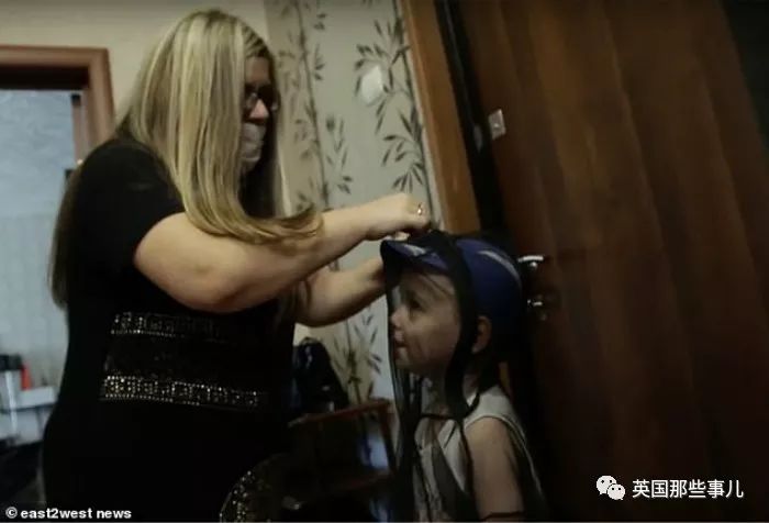 产后长络腮胡,女子生完孩子后长出满脸络腮胡