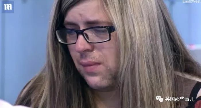 产后长络腮胡,女子生完孩子后长出满脸络腮胡