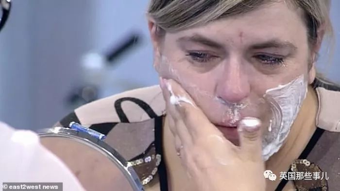 产后长络腮胡,女子生完孩子后长出满脸络腮胡