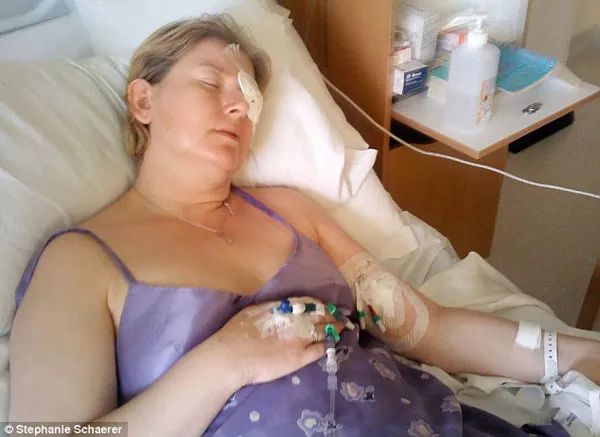 戴隐形眼镜感染的寄生虫,戴隐形眼镜眼睛里长虫子