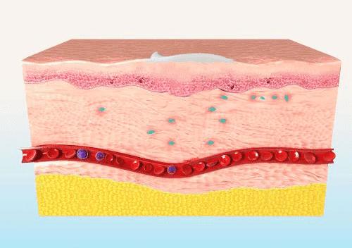 治痔疮最有效的痔疮膏,十多年的痔疮用痔疮膏效果怎么样
