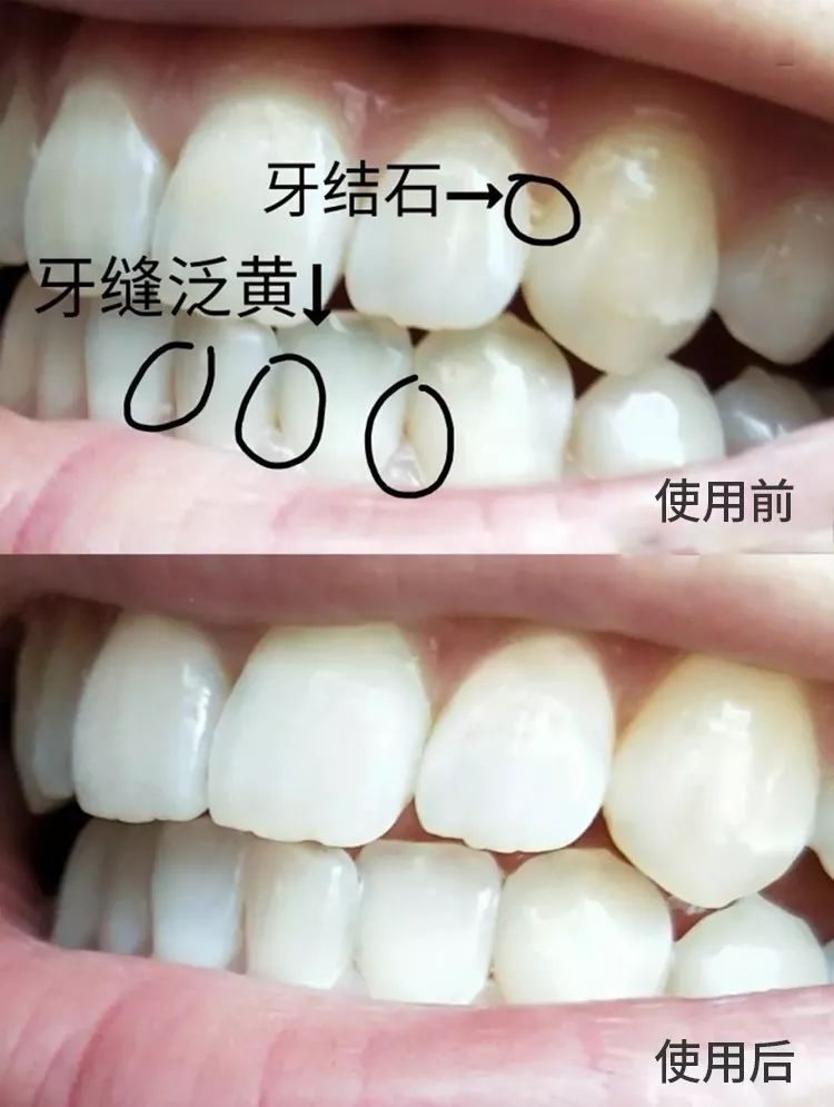 好物丨用它30秒吐掉嘴里所有脏东西，连呼吸都是水果味