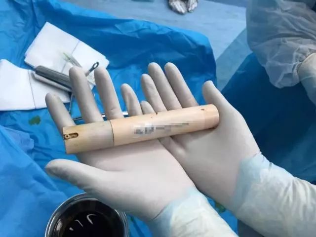 菊花一紧！男子洗澡摔倒，面霜棒插入肛门！进去容易出来难…