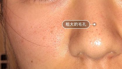 日本草莓鼻去黑头最有效的产品,byebye草莓鼻去黑头神器大揭秘