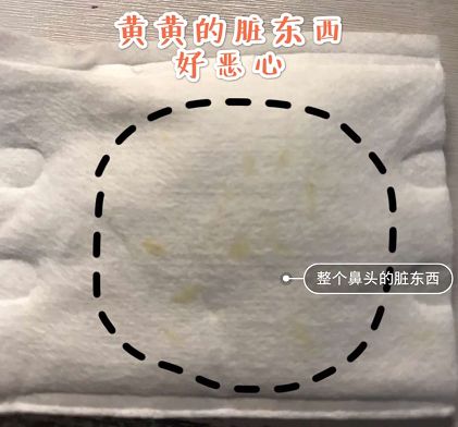 日本草莓鼻去黑头最有效的产品,byebye草莓鼻去黑头神器大揭秘