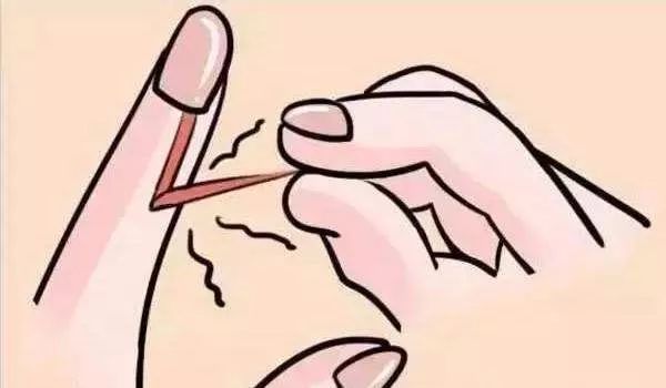 手指倒刺拔了变硬,手指倒刺顺着拔