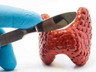 甲状腺腔镜手术后颈部多久消肿,甲状腺腔镜手术充气压力多少