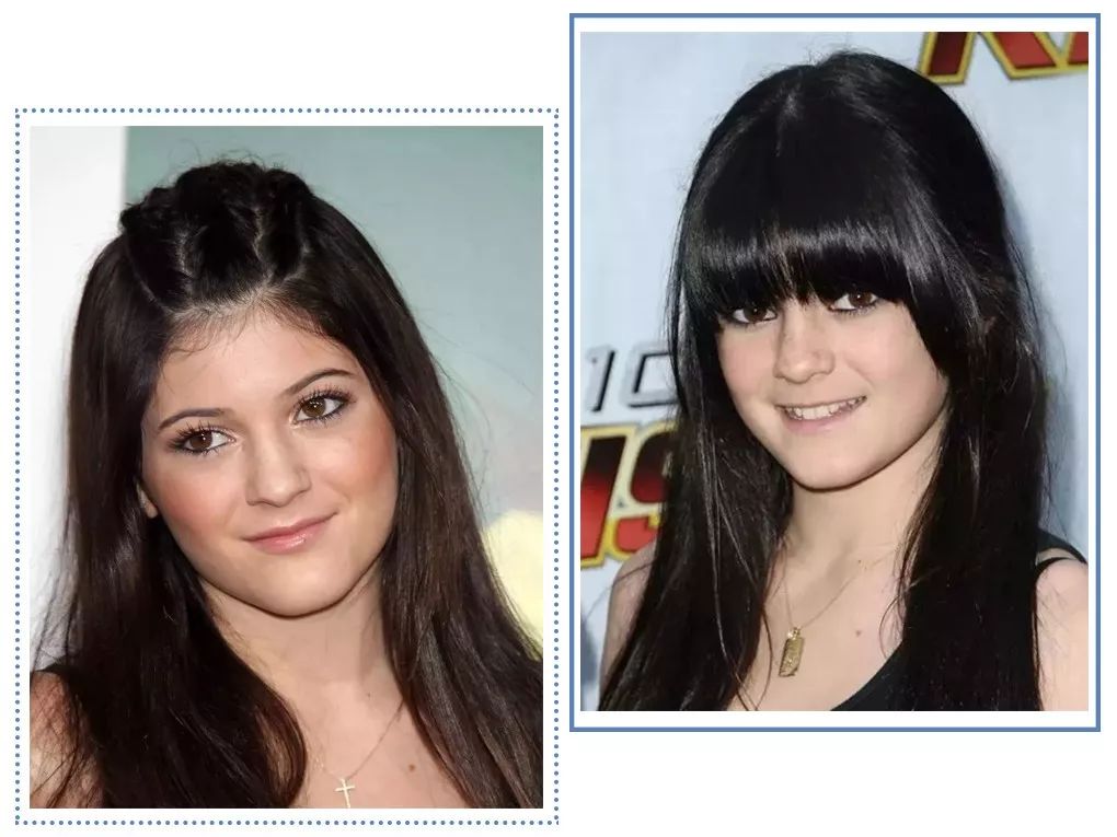 泫雅丰唇后颜值下跌？！但大家都爱这样的“香肠嘴”啊