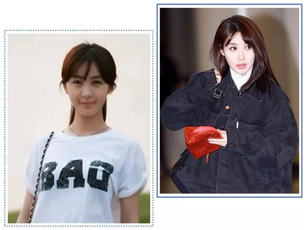 泫雅丰唇后颜值下跌？！但大家都爱这样的“香肠嘴”啊