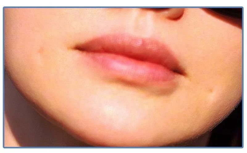 泫雅丰唇后颜值下跌？！但大家都爱这样的“香肠嘴”啊