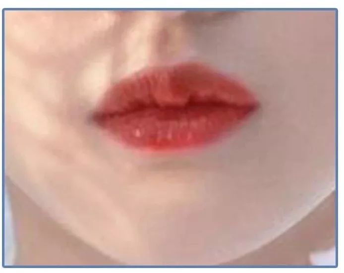 泫雅丰唇后颜值下跌？！但大家都爱这样的“香肠嘴”啊