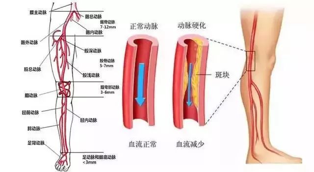 夏天为什么有一条小腿发凉,夏天小腿发凉