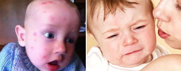 一小瓶止痒的药膏,一小瓶药水止痒叫什么