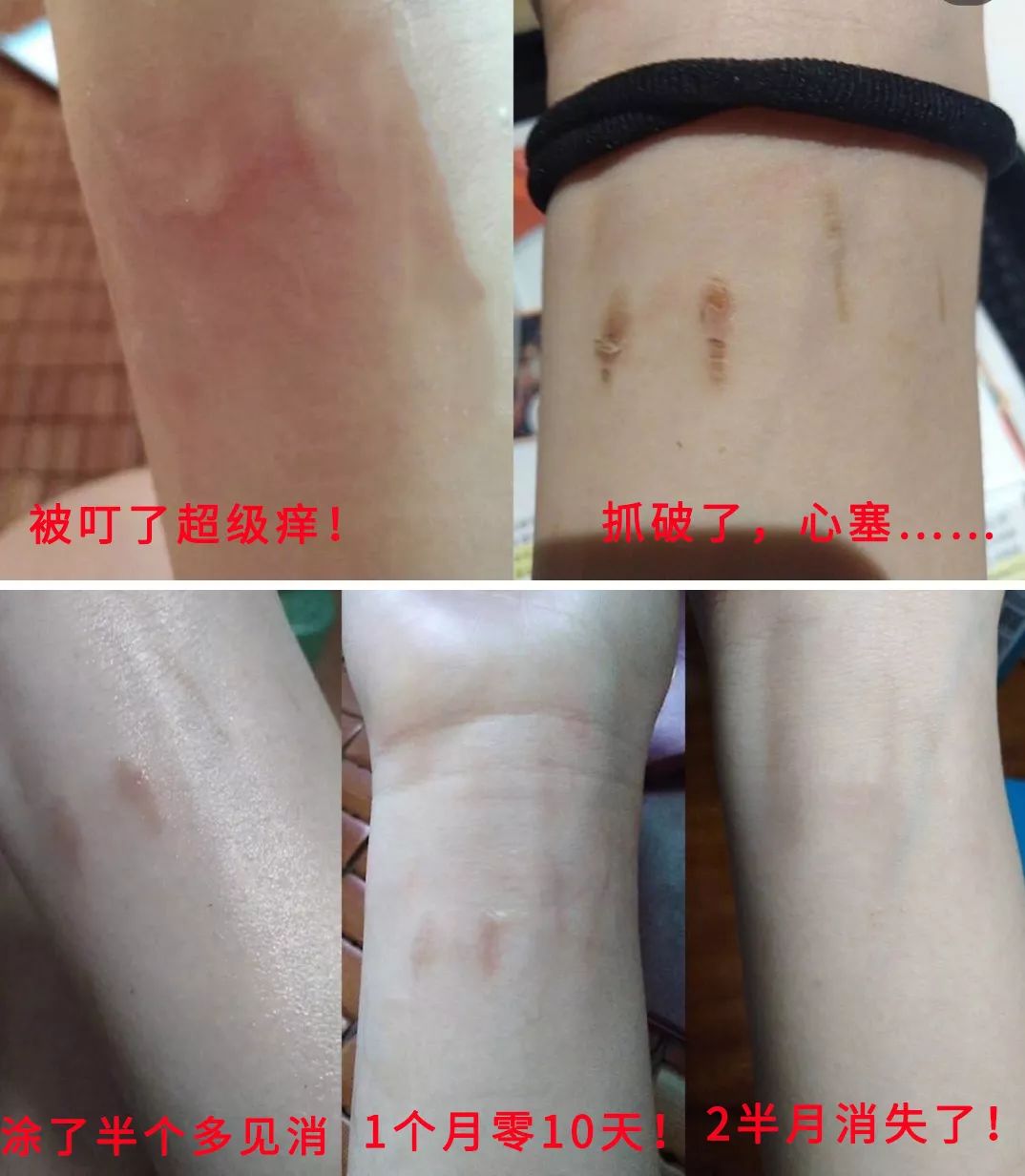 一小瓶止痒的药膏,一小瓶药水止痒叫什么