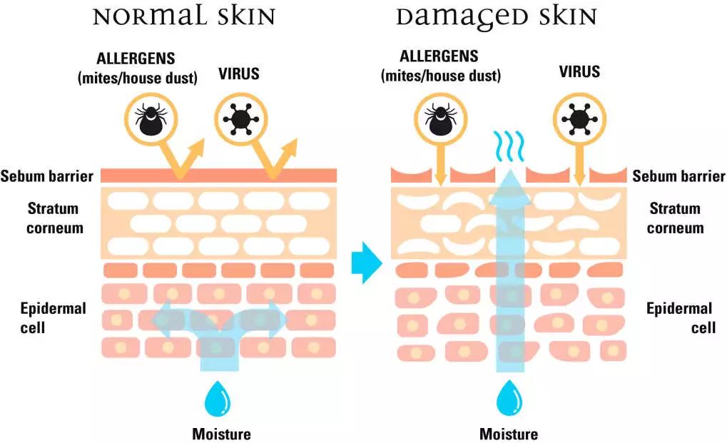抗皱秘籍你学还是不学,抗皱免费教你一个方法