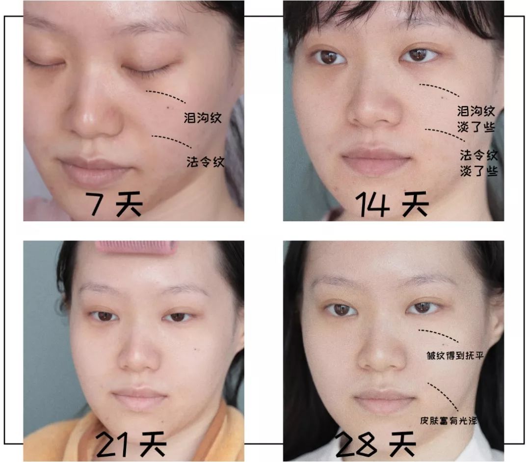 抗皱秘籍你学还是不学,抗皱免费教你一个方法