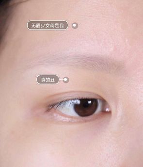 纹眉一周后眉毛还没完全掉痂,纹眉之后我的眉毛不长了