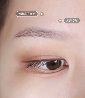 纹眉一周后眉毛还没完全掉痂,纹眉之后我的眉毛不长了