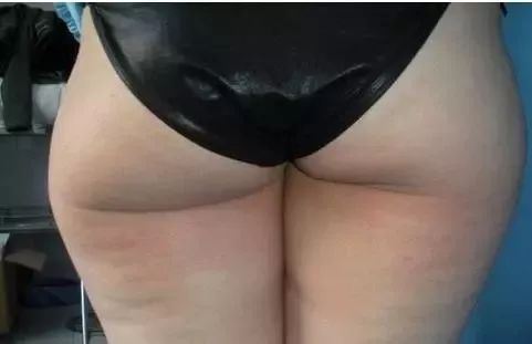 半个娱乐圈撞*裤内**？谁叫它提臀细腰又瘦腿