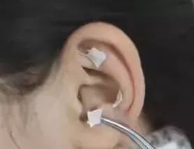 【人大评议专区·聚焦健康科普】淄博市妇幼保健院：孕吐难忍，中医缓解有妙招？