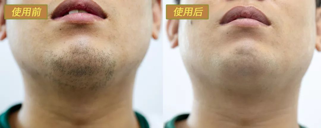 200年美军军工品质！双悬浮刀网比TT还薄，剃须渣都不留