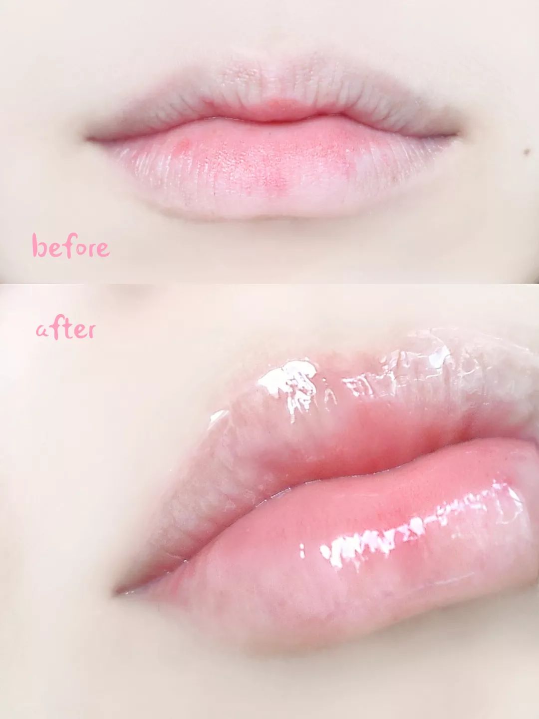 丰唇怎样让唇边更立体,适合丰唇的唇形