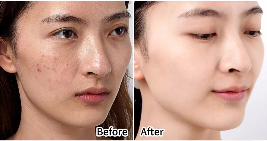 婆孙恋,婆孙恋电视剧