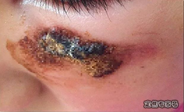 芦荟胶的危害有多可怕,芦荟胶的危害到底有多可怕