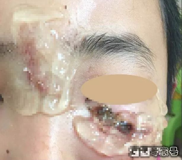 芦荟胶的危害有多可怕,芦荟胶的危害到底有多可怕