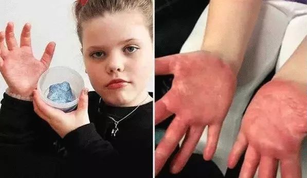 触电玩具的危险,儿童玩具触电