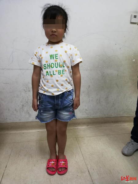 女孩确诊骨瘤妈妈发抖,10岁女孩鼻窦炎反复