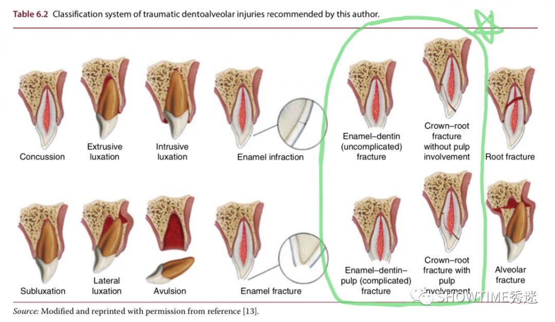 猎奇钢牙套——一切都是为了让牙齿“活”下来。「919爱牙科普行动」