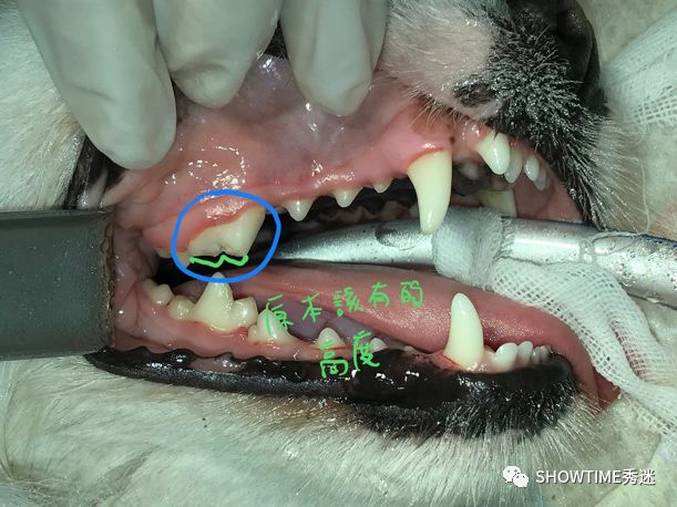 猎奇钢牙套——一切都是为了让牙齿“活”下来。「919爱牙科普行动」