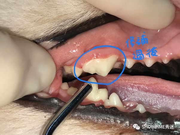 猎奇钢牙套——一切都是为了让牙齿“活”下来。「919爱牙科普行动」